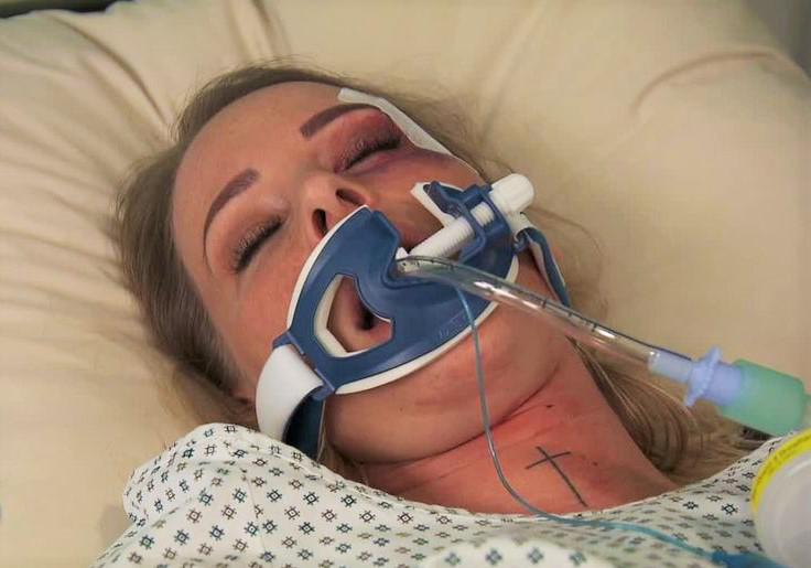 Intubation Porn - Intubated Bondage | BDSM Fetish